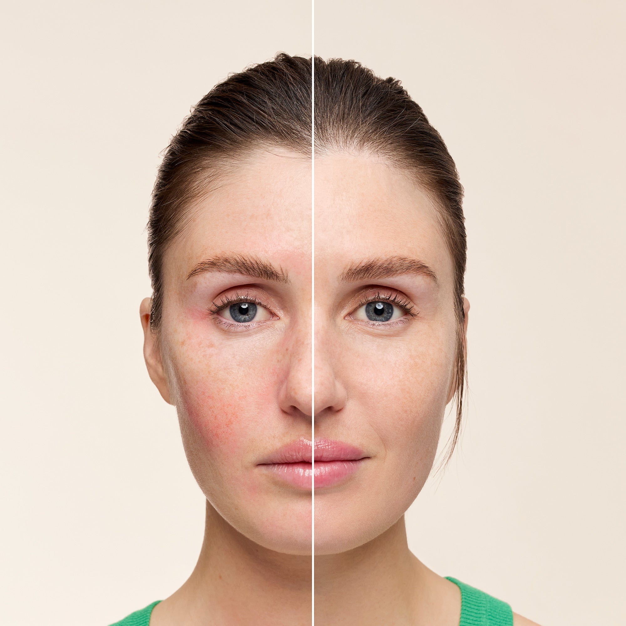 Before-and-after skincare result showing a model’s face with visible redness on one side and a calmer, more even complexion on the other, illustrating the anti-redness skincare effect of Embryolisse SOS Corrective Cream.